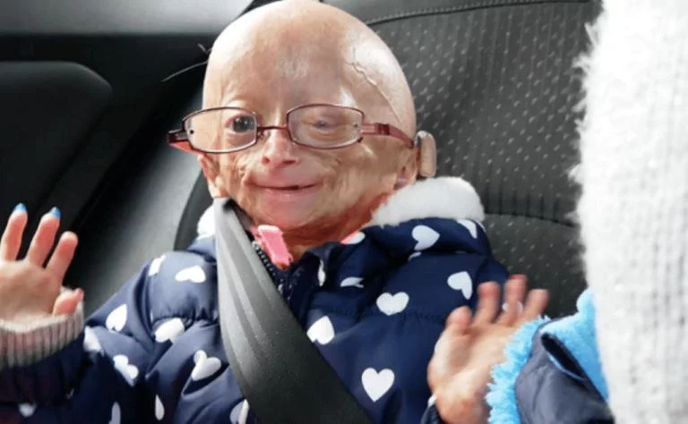 Adalia Rose Bio, Is She Dead or Alive? Here Are The Facts